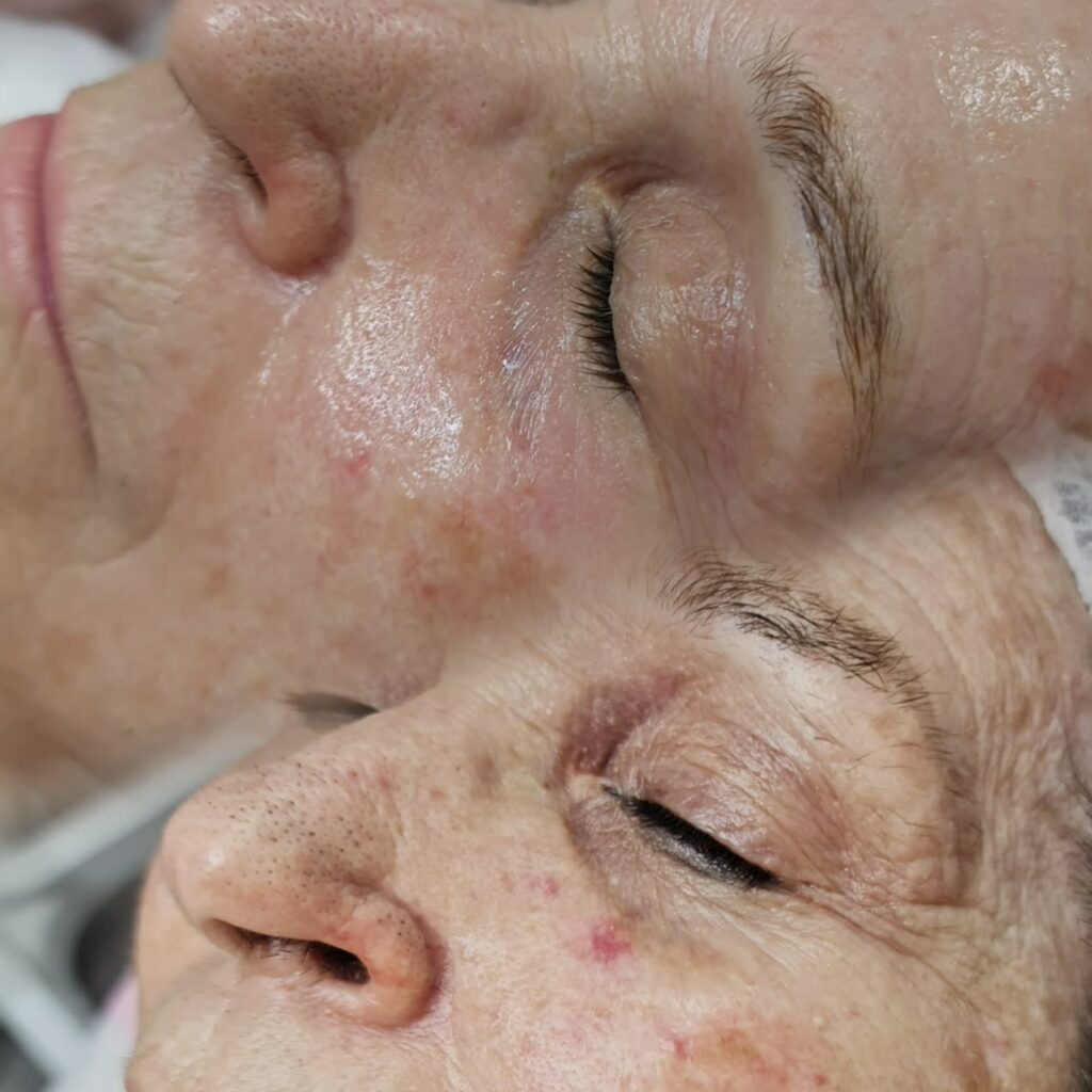 Clínica estética en Mislata